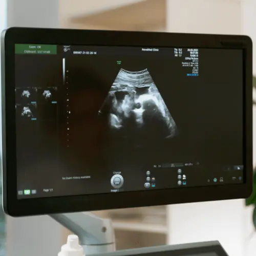 Private ultrasound scan in manchester