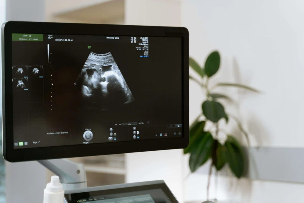 Private Ultrasound Scan